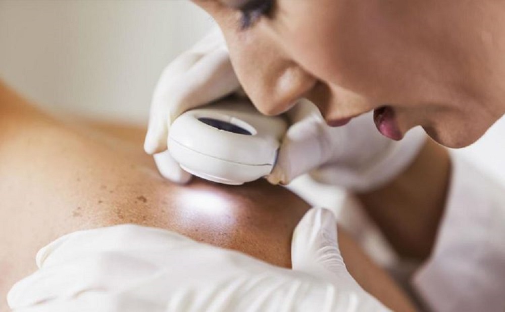 Hasta 15 casos de cáncer en la piel son diagnosticados por semana en el Centro Dermatológico de Culiacán