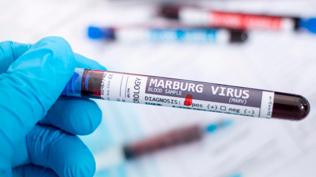Tan mortífero como el ébola | Se declara brote de virus de Marburgo en Ghana, anuncia la OMS