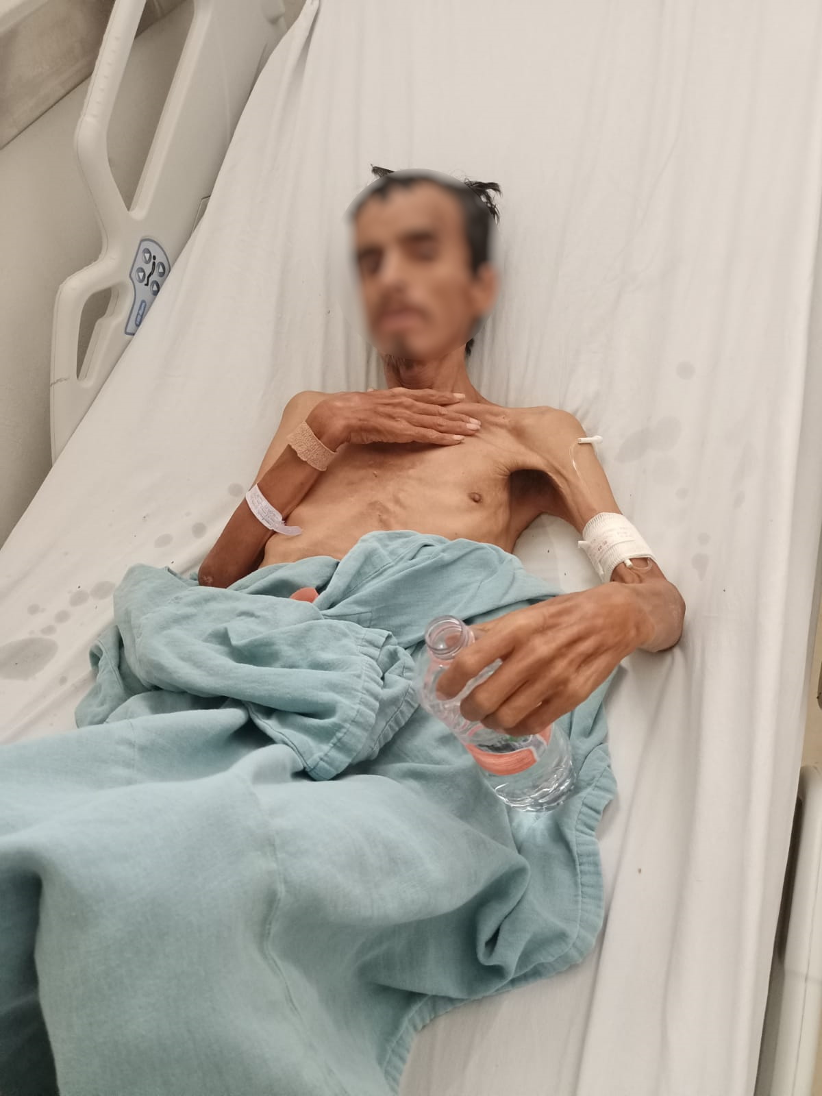 Don Arnulfo sigue abandonado en un hospital de Guasave pese a que ya no contagia su tuberculosis; ni DH lo atiende