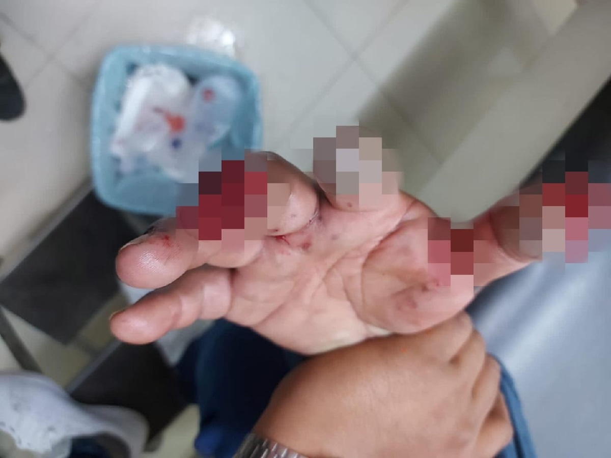 Cuete le vuela un dedo a joven de El Zapote, en Mazatlán