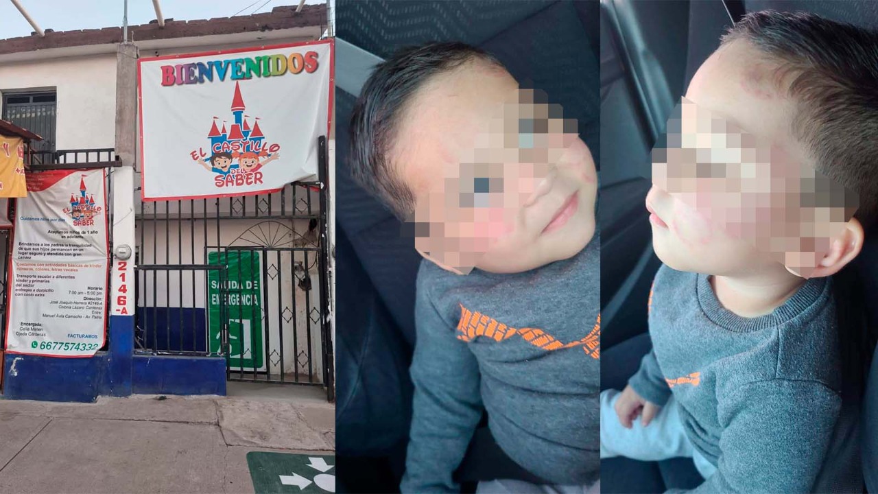 Ante el MP denuncia madre a guardería de Culiacán; su bebé fue mordido varias veces en la cara