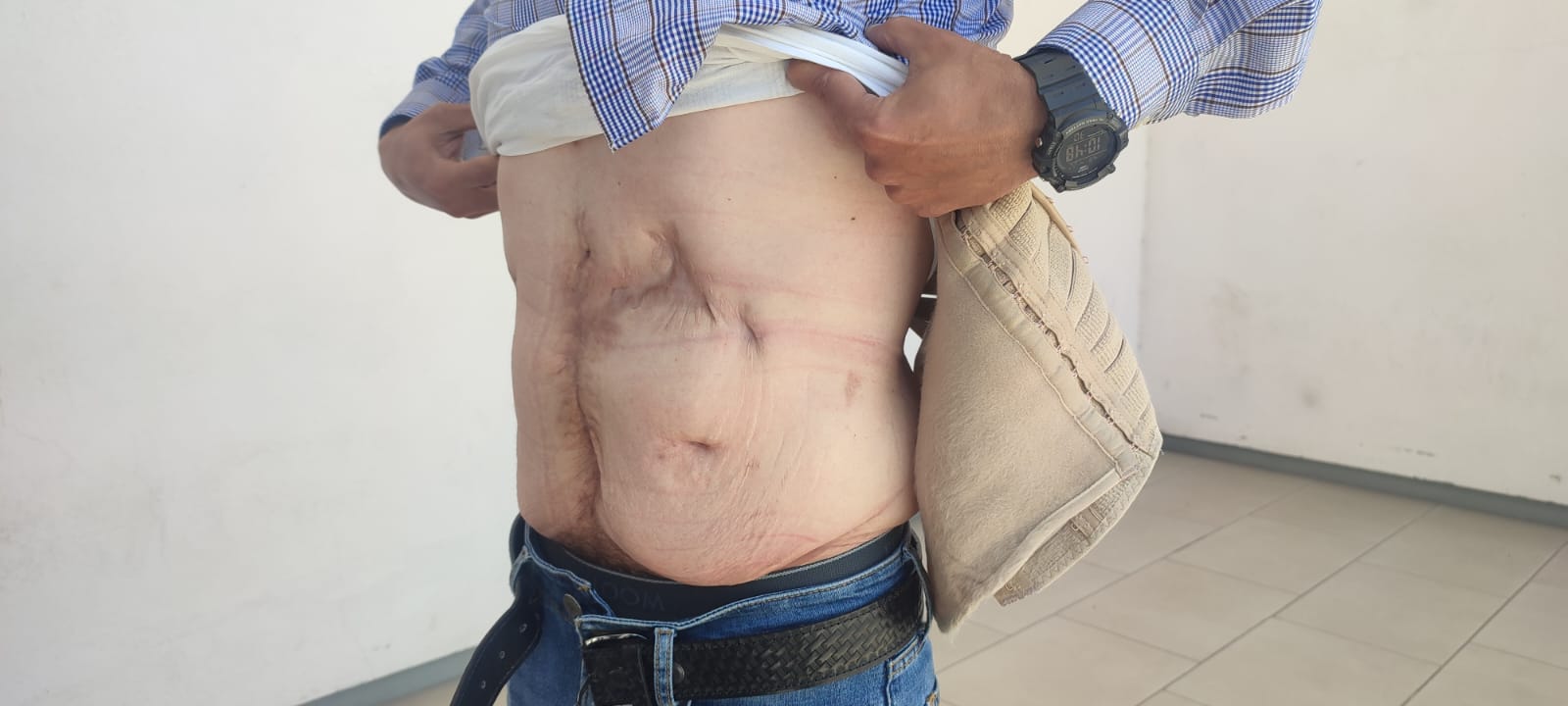 ‘Que el doctor pague por lo que me hizo a mí y lo que le hizo a Magnolia’: Víctima; acusa de perforarle dos órganos