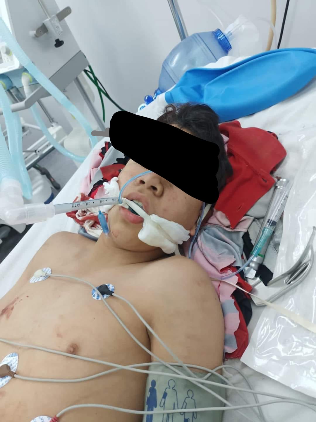 Se busca a la familia de José, menor de 14 años accidentado en Bellavista