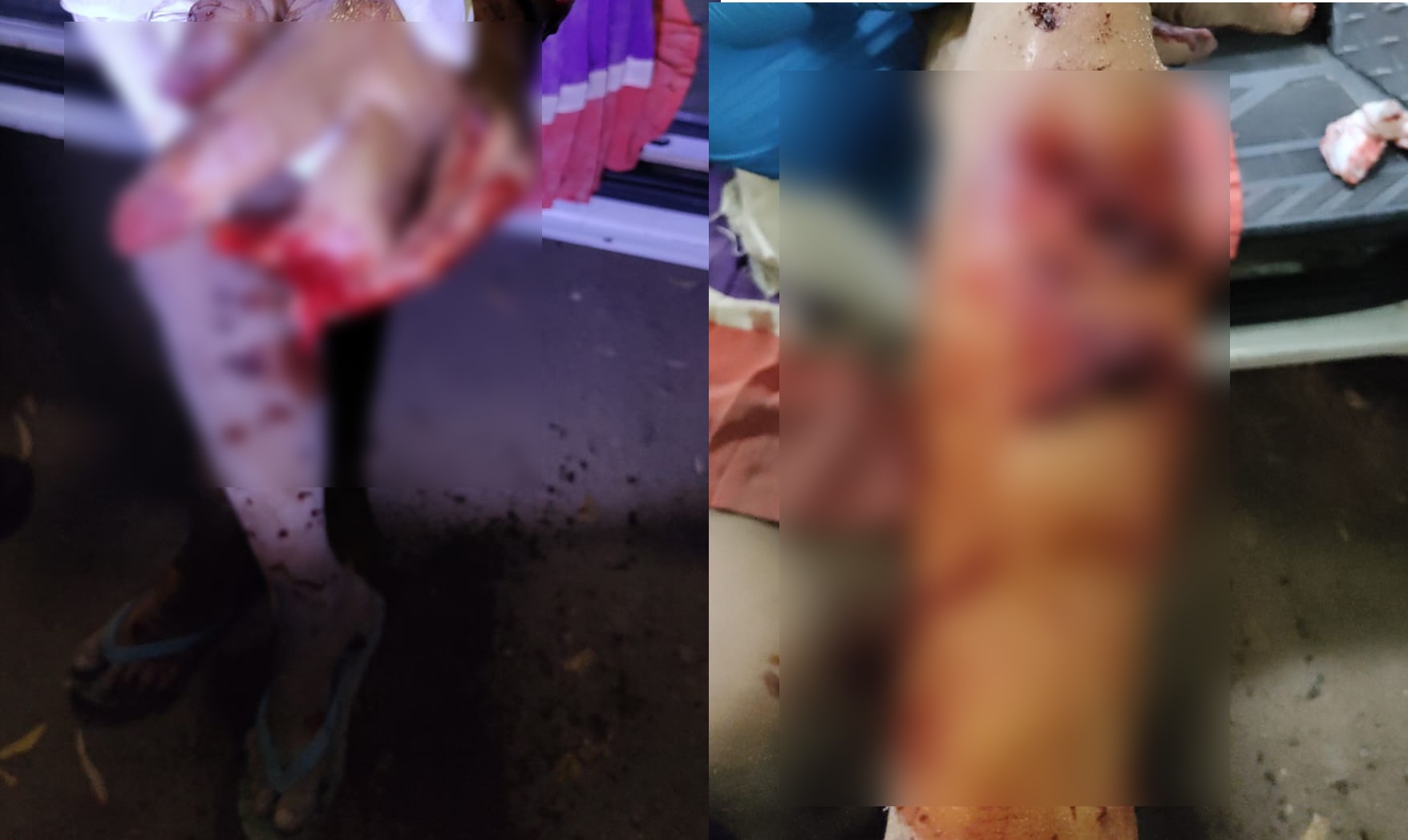 A doña Antonia la atacó un perro, el animal le arrancó un dedo y le dejo severas lesiones en su cuerpo