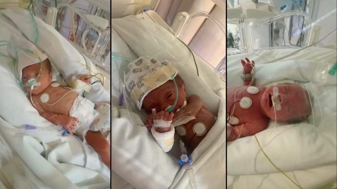 Óscar, Ismael y Emanuel nacieron de 7 meses en Mazatlán, ahora necesitan de la ayuda ciudadana