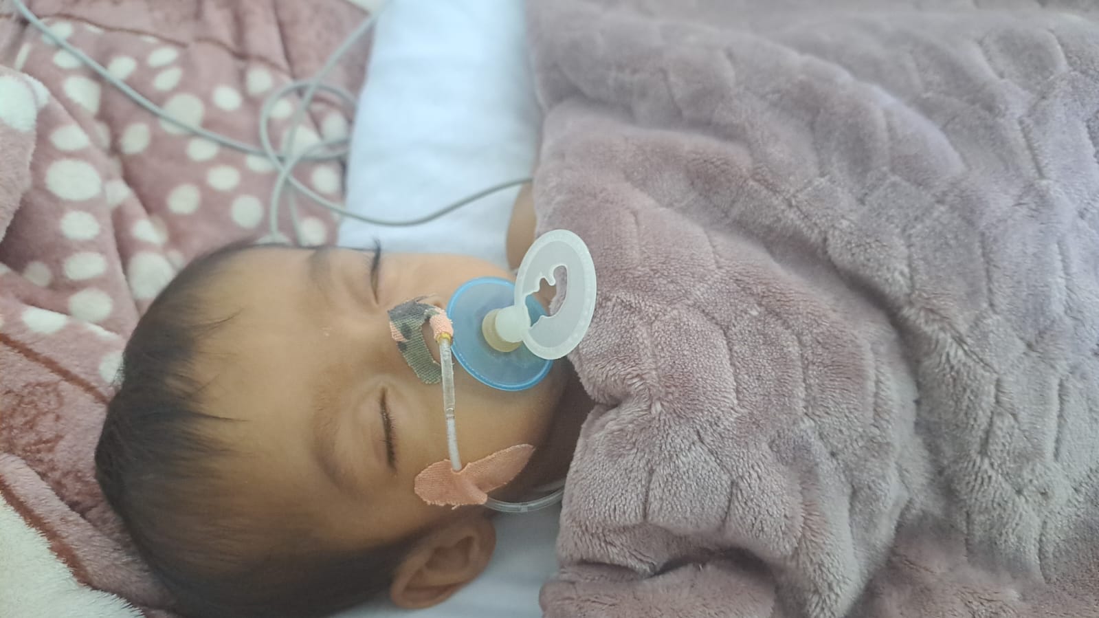 Ángel Tadeo padece atresia de vías biliares y ocupa 1.1 mdp para un trasplante de hígado