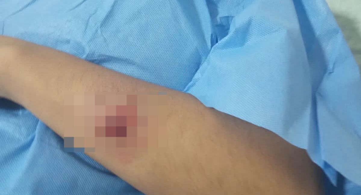 ¡Le dio un hachazo y la mordió! El violento ataque de un sujeto a su esposa, en Choix