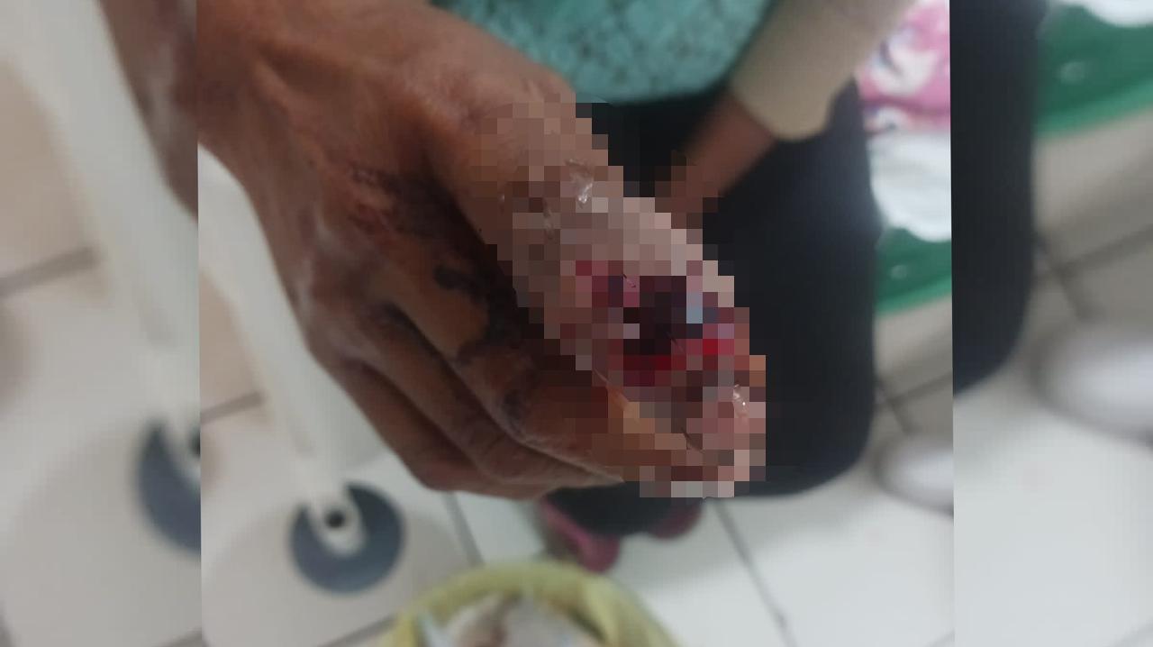 En Choix, mujer recibe un balazo en su mano tras discusión con su hermano