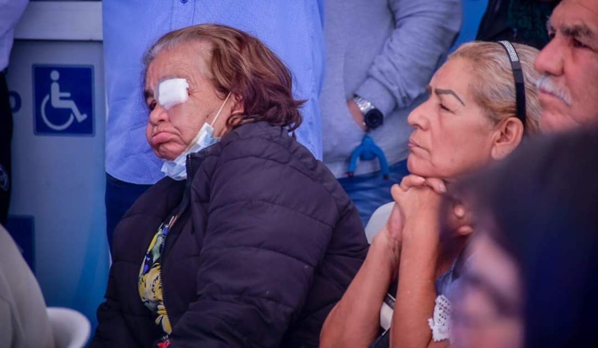 Realizan 50 cirugías gratuitas de Pterigión a personas de escasos recursos en Mazatlán