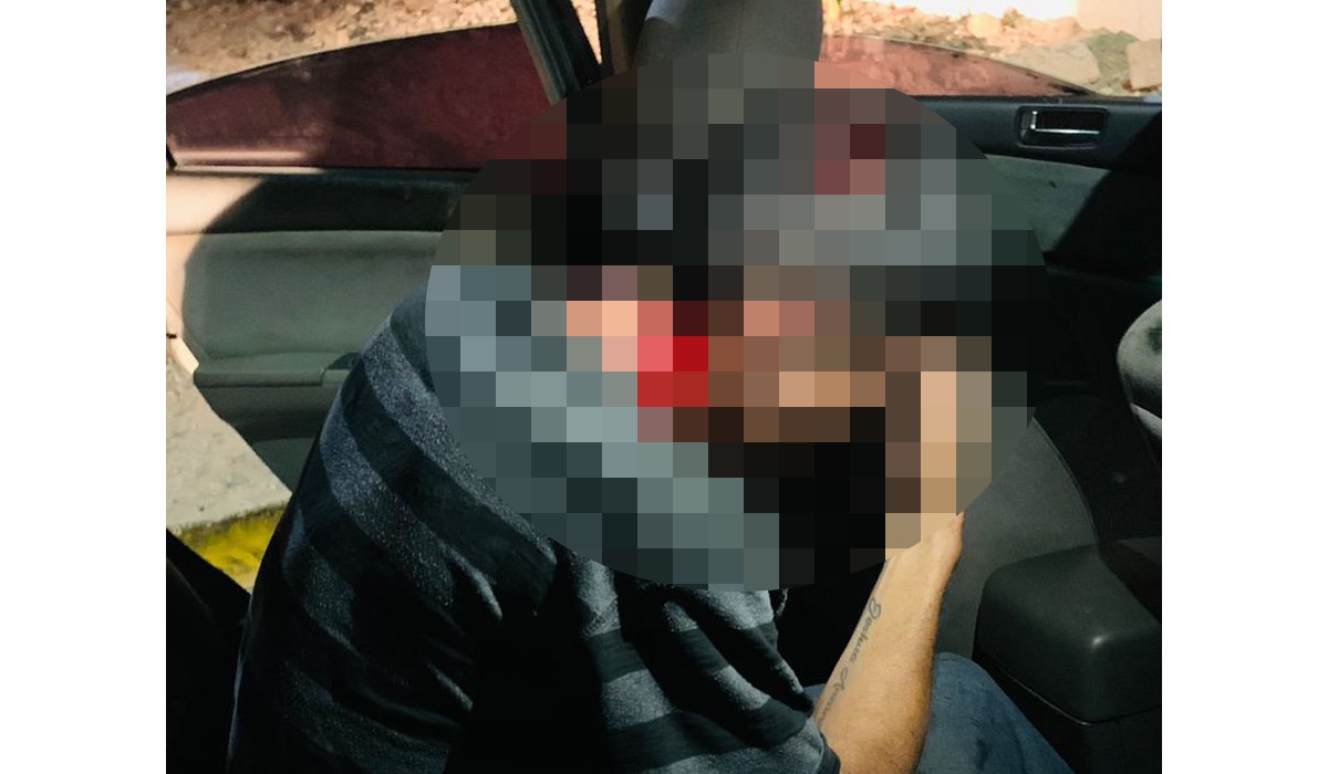 Vecino del puerto de Topolobampo es agredido por sujetos desconocidos
