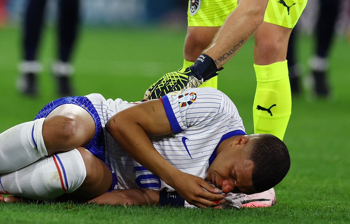 Kylian Mbappé se fractura la nariz en la Eurocopa 2024 y será operado