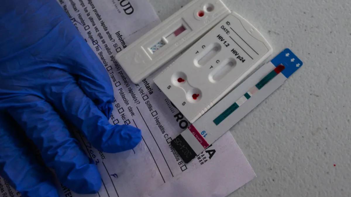 Realizarán pruebas gratis de sífilis, hepatitis C y VIH en Mazatlán