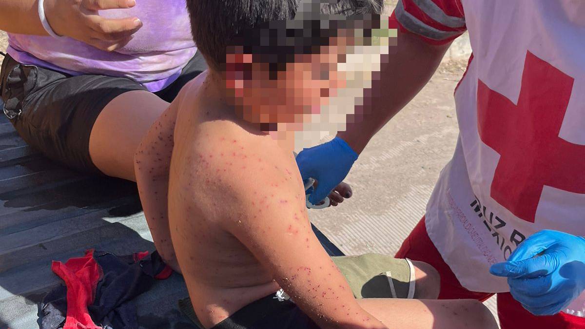 Dos menores de edad ingresan al Hospital General de Los Mochis luego de recibir más de 50 picaduras de abejas
