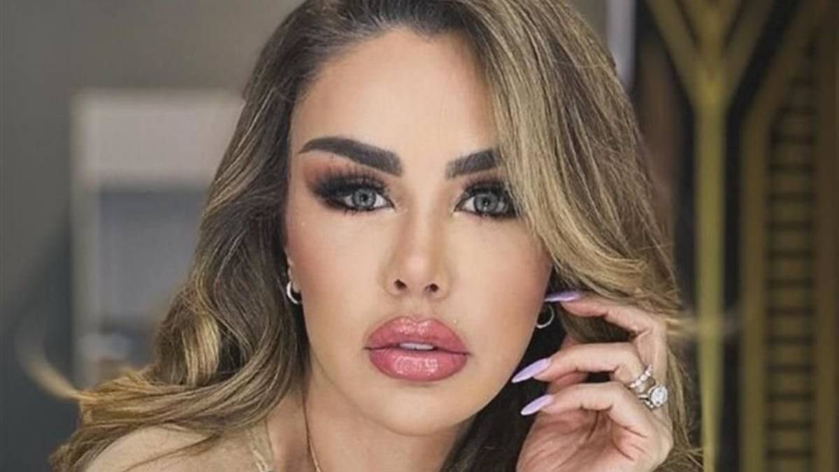 Ninel Conde sorprende con su nuevo rostro tras retiro de biopolímeros en Turquía