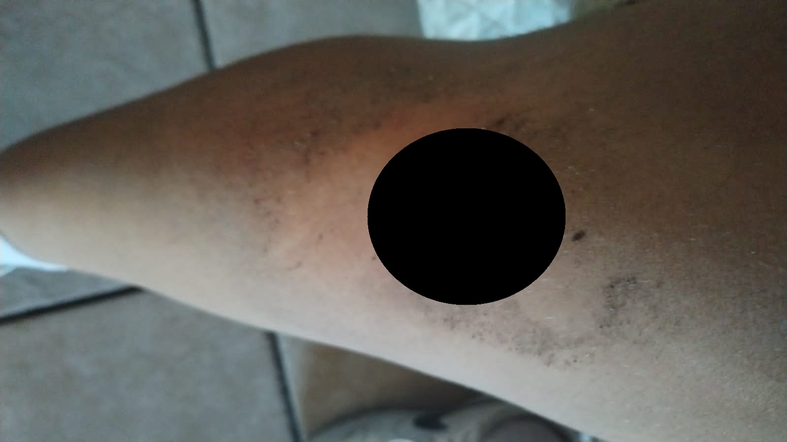 Recibirá sanciones el chofer de camión urbano por accidente con estudiante: vialidad