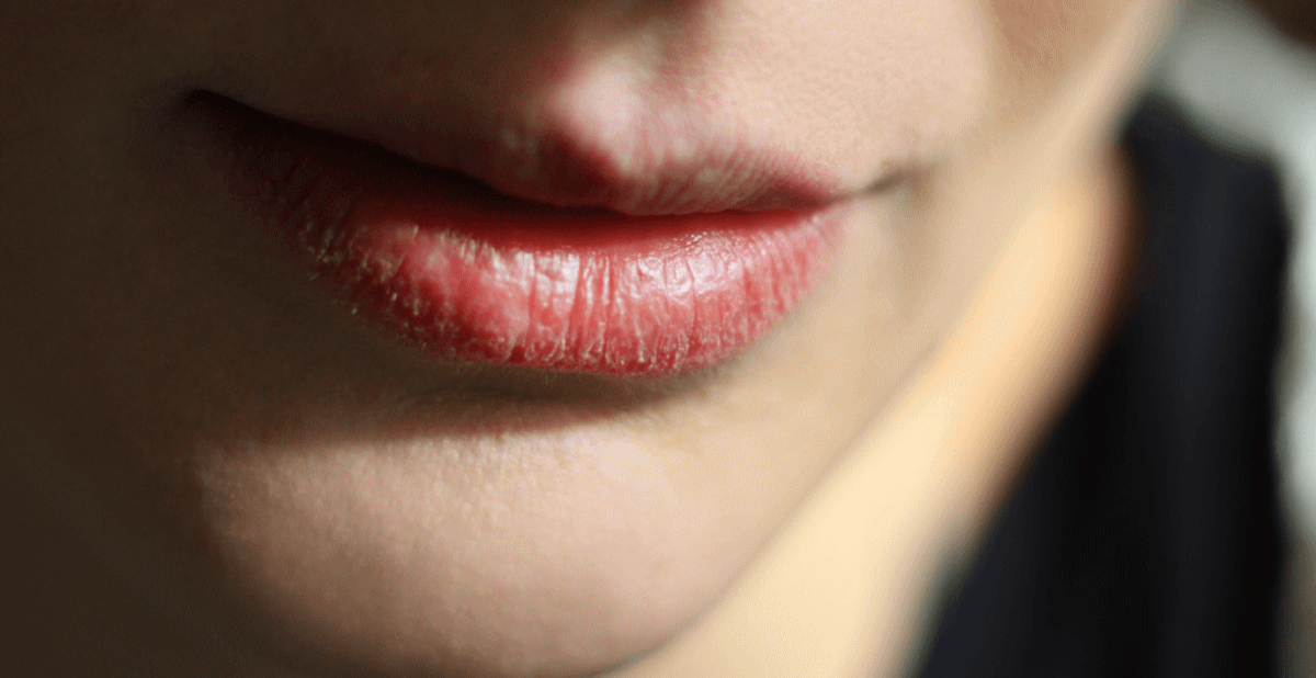 ¿Labios agrietados? Checa como cuidarlos durante el invierno