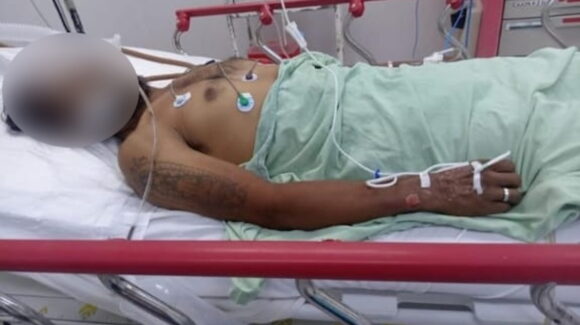 Familiares de Valentín Humberto piden apoyo urgente: necesita una segunda operación tras ser atropellado en Guasave