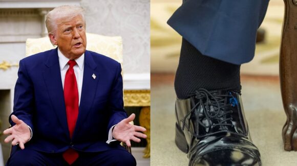 Trump presenta insuficiencia venosa crónica ¿Qué es y cuáles son sus factores de riesgo?