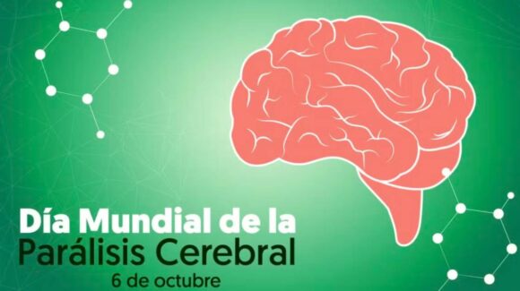 Día Mundial de la Parálisis Cerebral: ¿cómo visibilizar la condición neurológica más común en la infancia?