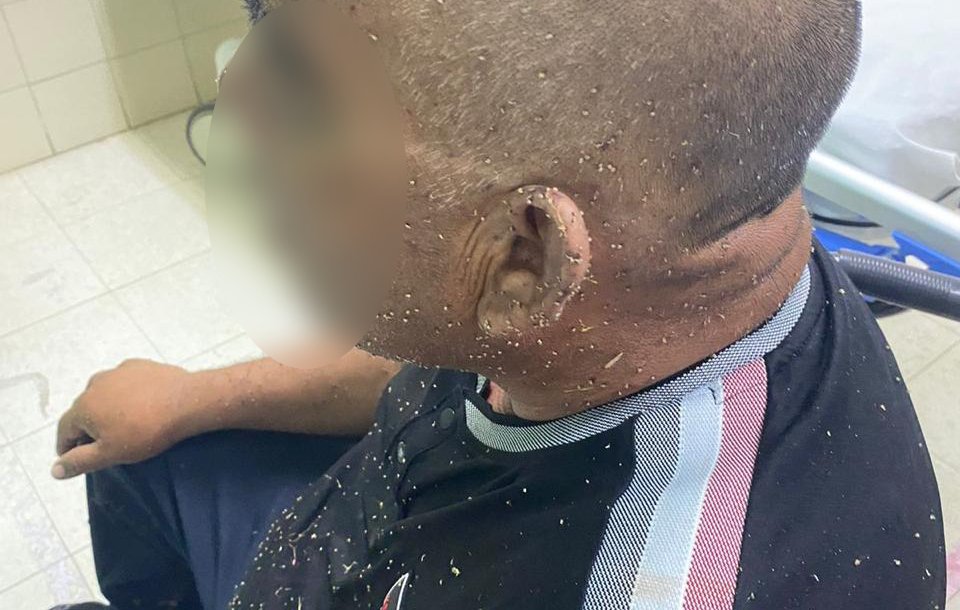 adulto con mil piquetes de abejas en salvador alvarado sinaloa