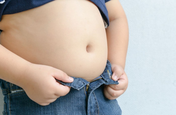 Obesidad infantil