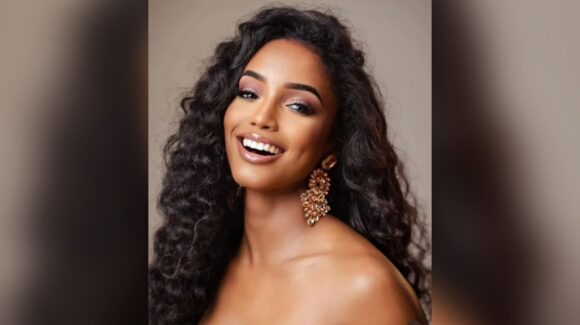 Miss Jamaica regresará a su país para continuar con su tratamiento tras caída en la preliminar de Miss Universo 2025