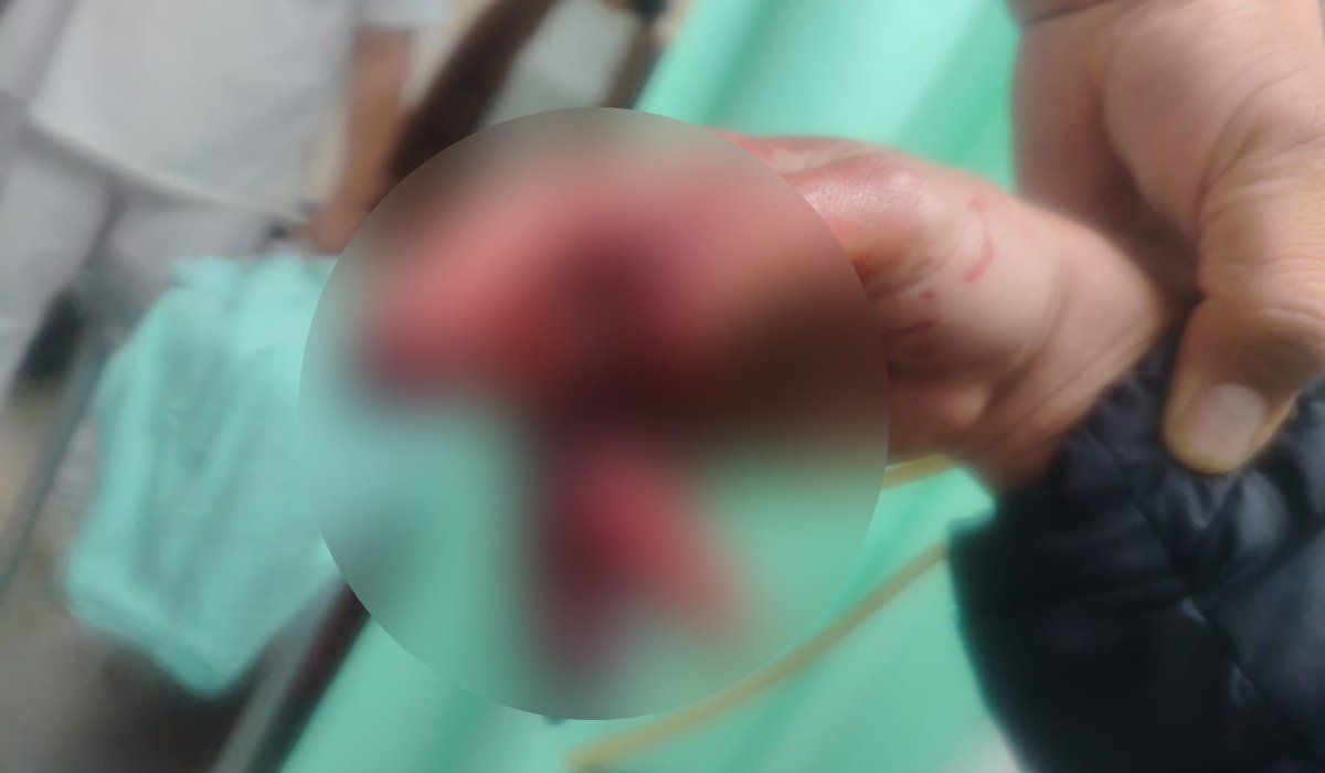 Joven resulta lesionado por pirotecnia en Guasave, Sinaloa