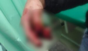 Joven resulta lesionado por pirotecnia en Guasave, Sinaloa