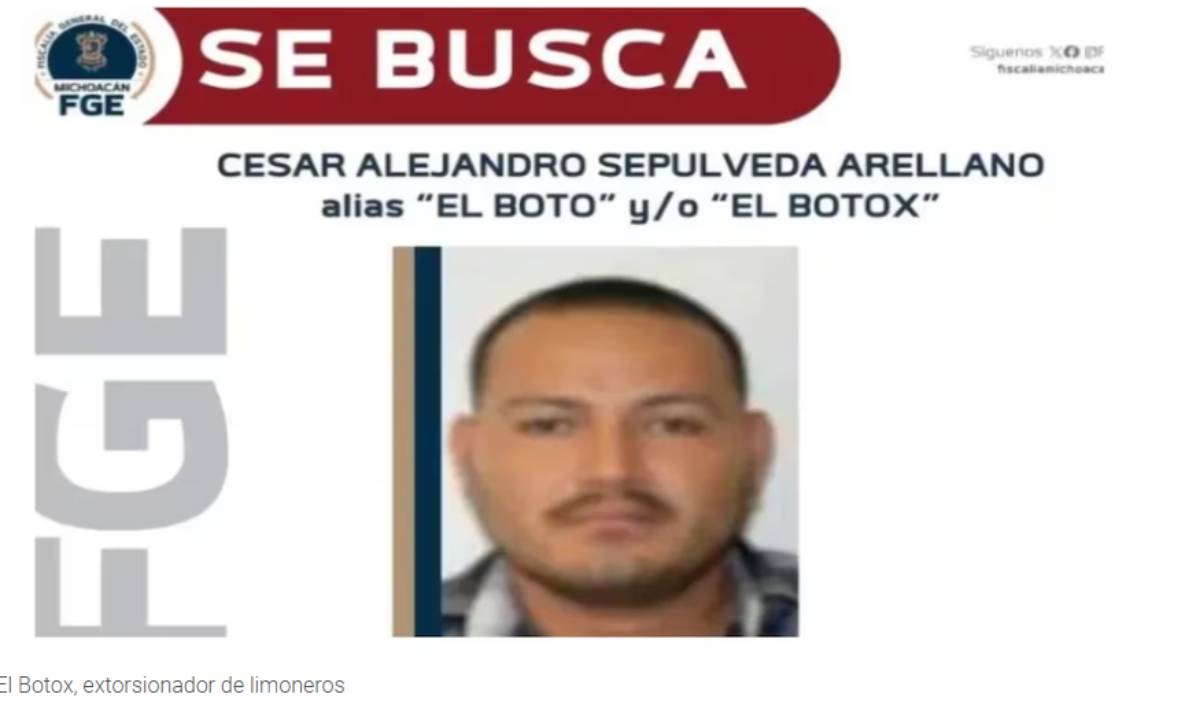 'El Botox'