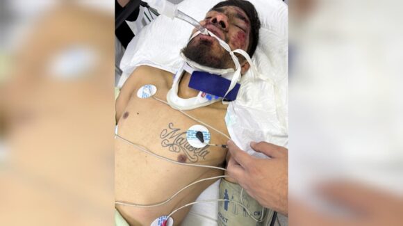 Buscan a familiares de hombre accidentado sobre la México 15, en Guasave, Sinaloa