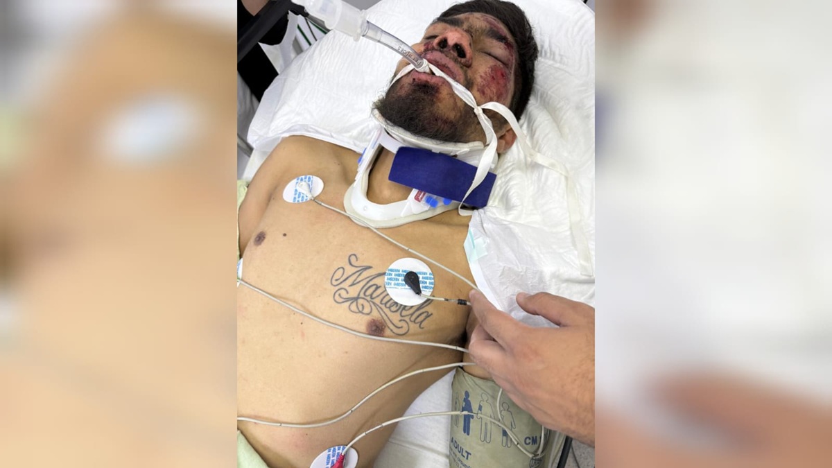 Buscan a familiares de lesionado en accidente de moto en Guasave