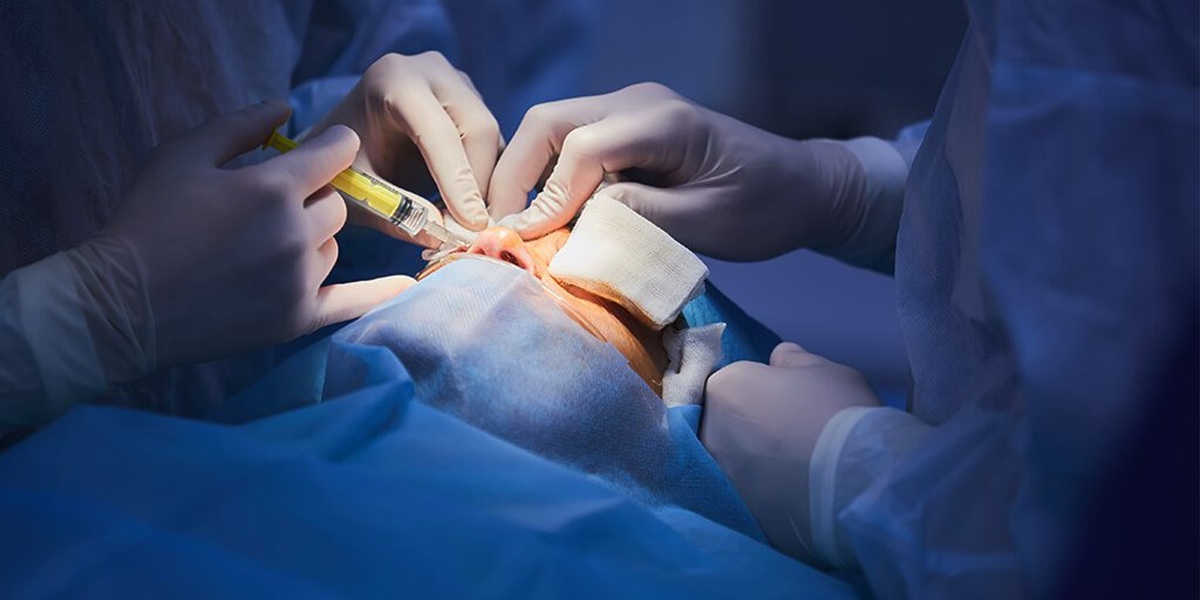 Cirugía de rejuvenecimiento facial