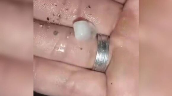 Granizada sorprende de madrugada a Mazatlán, Sinaloa y marca la primera lluvia de 2026 este lunes 12 de enero