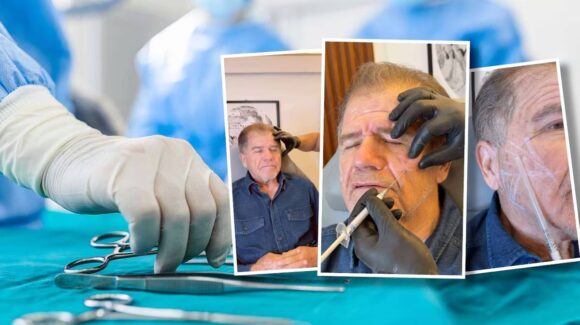 José Eduardo ‘Cuco’ Rovirosa reaparece con bótox y busca de nuevo la alcaldía de Macuspana