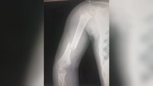 cae letra de los mochis sobre niña de un año en el parque sinaloa