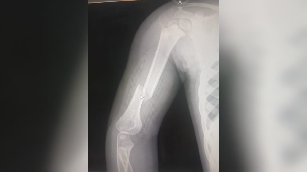 cae letra de los mochis sobre niña de un año en el parque sinaloa