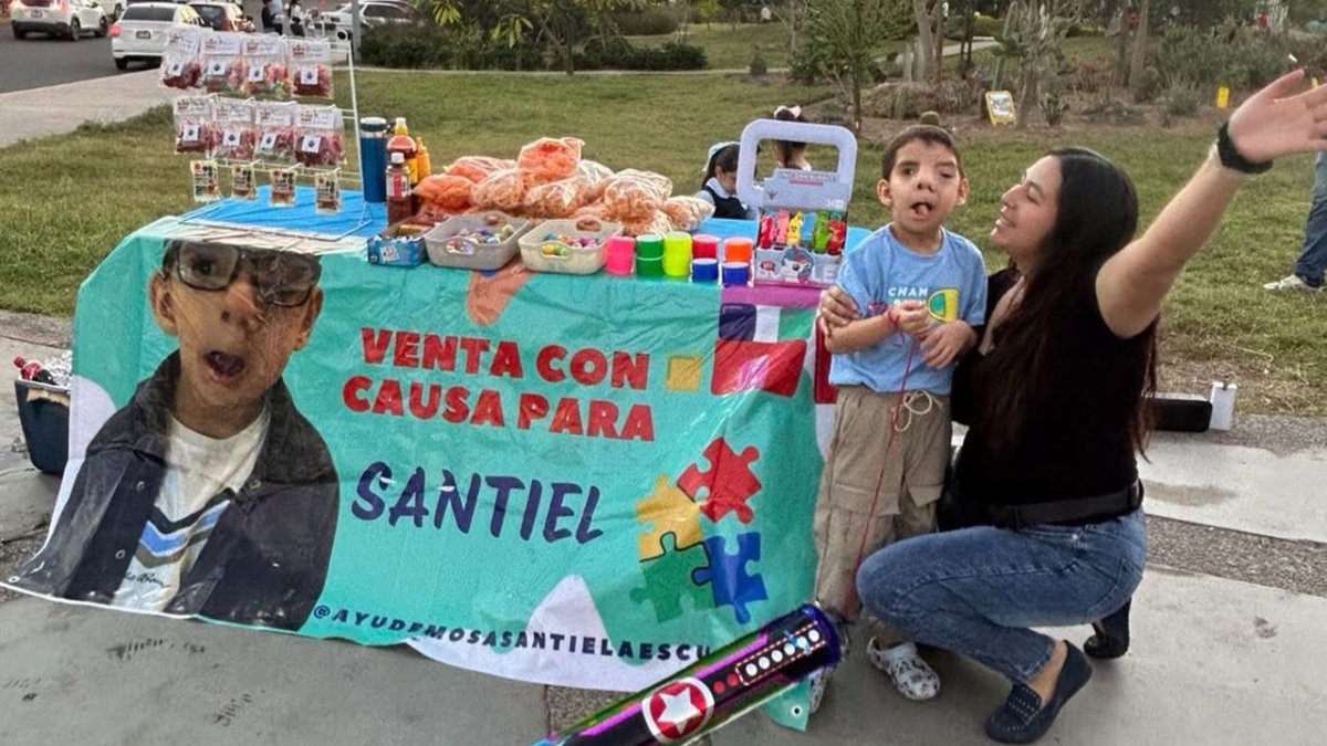 santiel necesita apoyo sera sometido a septima cirugia reconstructiva