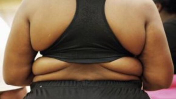 Día Mundial de la Obesidad: estigma, ansiedad y depresión, efectos ignorados del sobrepeso