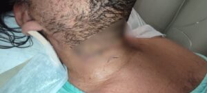 Negligencia IMSS Mazatlán