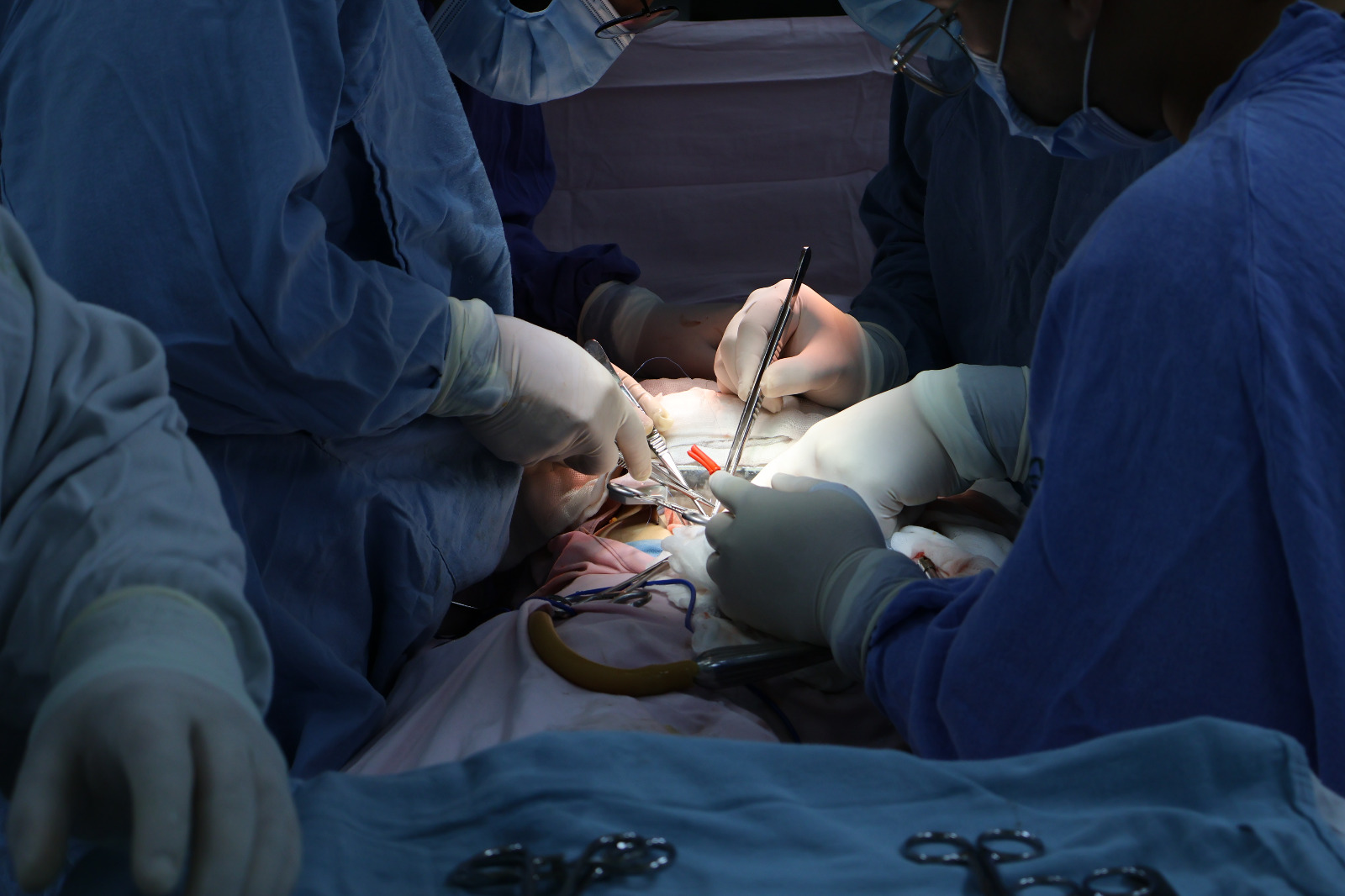Médicos especialistas realizando trasplante renal