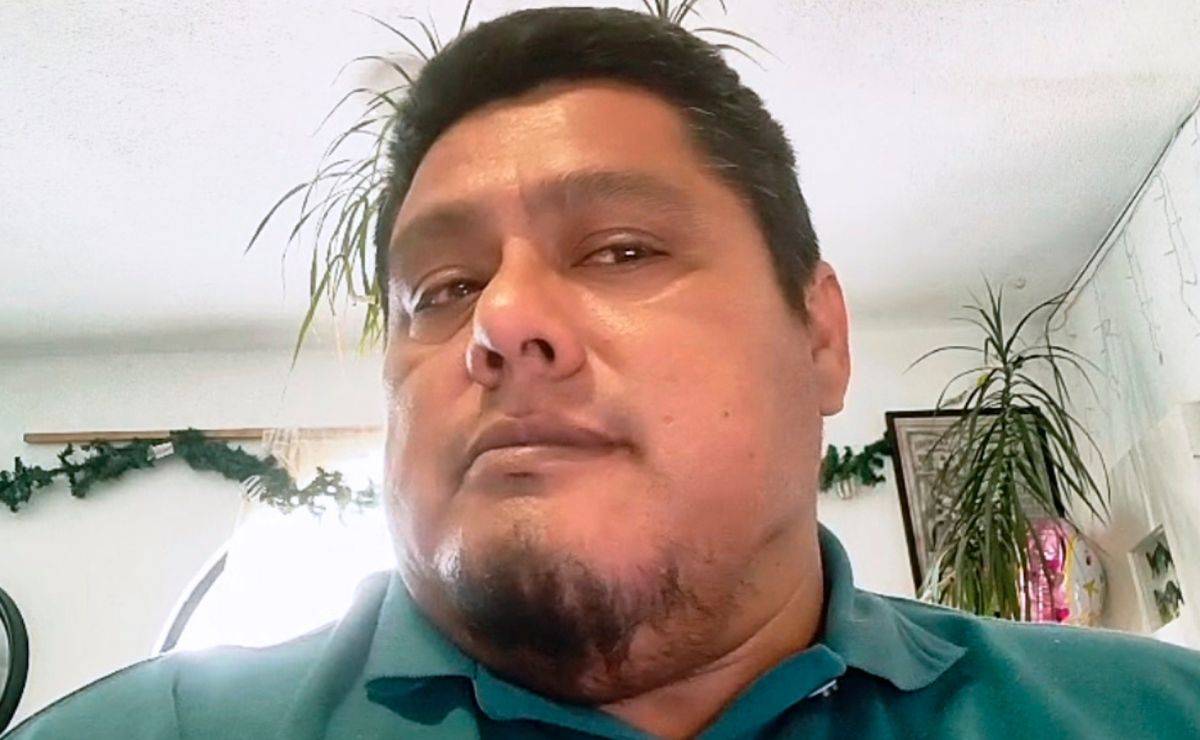 Zindy Antonio, paciente que requirió cirugía maxilofacial.