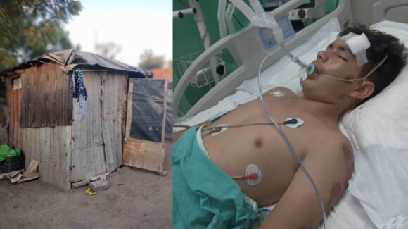 ¿Recuerda a Sergio? El niño atropellado en su bicicleta necesita otra cirugía; buscan apoyo y donadores