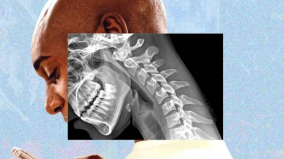 “Cuerpo de teléfono”: cómo la tecnología afecta cuello, piel, vista y manos