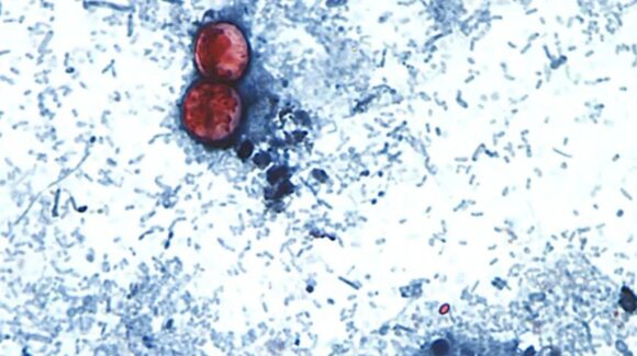 Brote de ciclosporosis en Estados Unidos enciende alertas; ¿podría llegar a México?