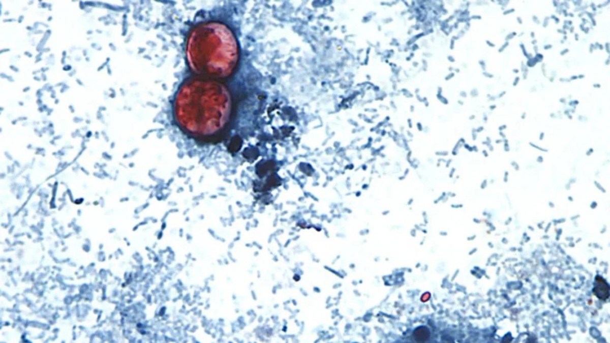 Cyclospora, parásito que provoca la ciclosporosis