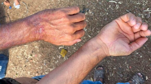 Denuncian brote de enfermedades por agua contaminada en dos comunidades de El Fuerte, Sinaloa