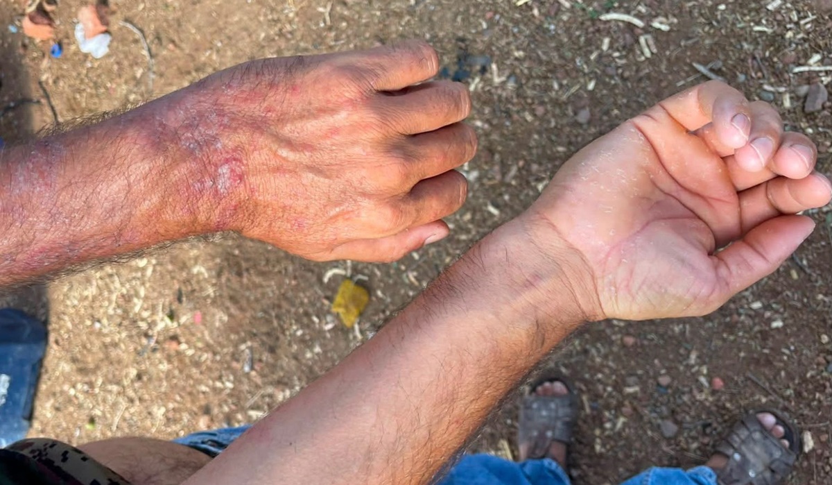 Denuncian problemas de salud en dos comunidades de El Fuerte por agua contaminada