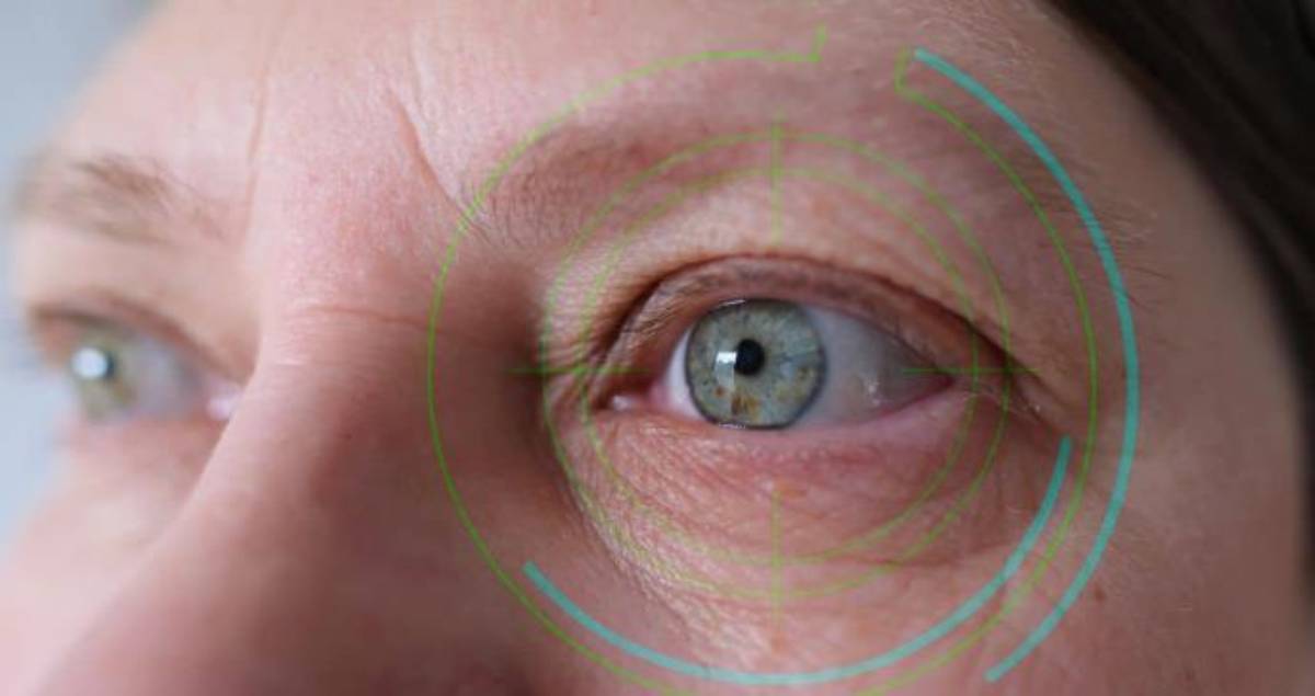 Un tic en el ojo, también conocido como blefaroespasmo o mioquimia orbicular, es una contracción involuntaria del párpado