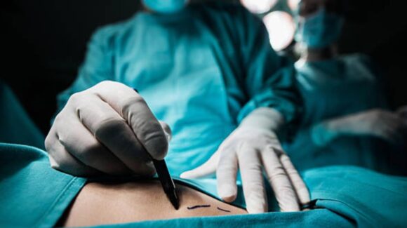 En Tijuana, Laura Rocío acusa supuestas secuelas tras mala cirugía estética y después se quita la vida