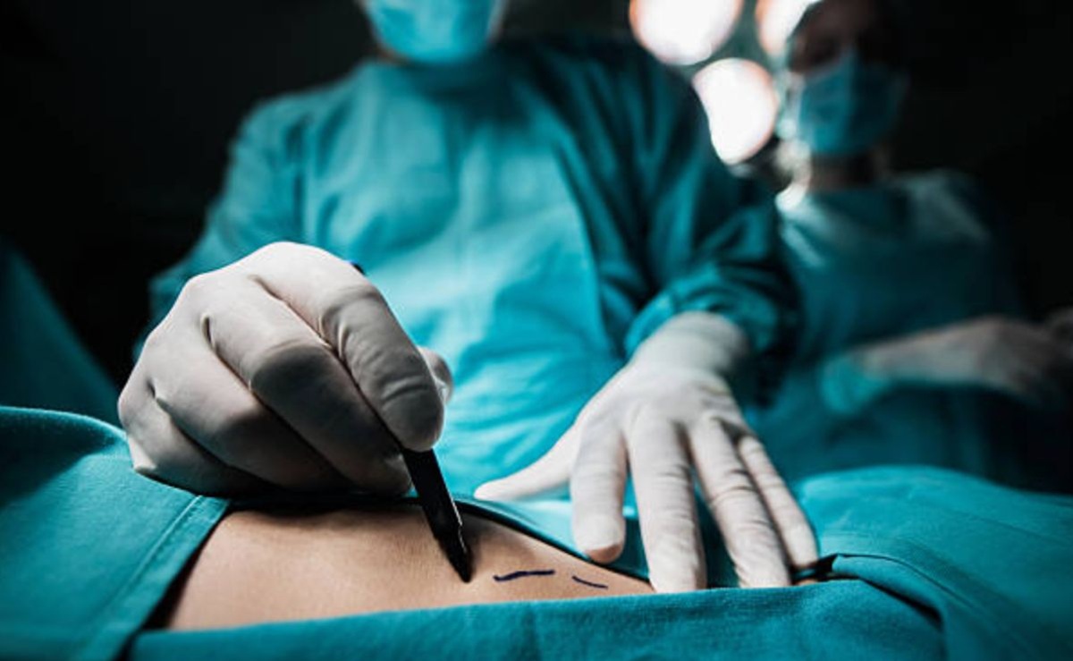Doctor realizando cirugía estética
